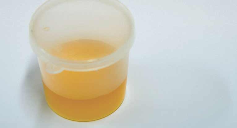 Where To Buy Clean Urine